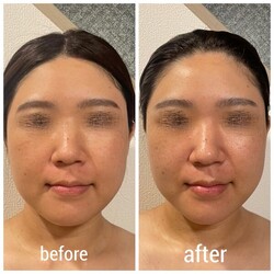 ☆before after②