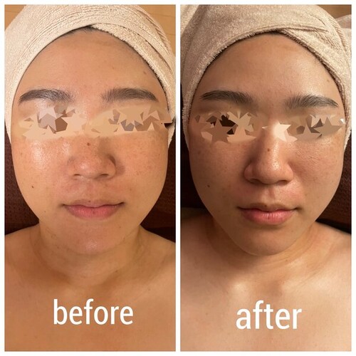 ☆before after①