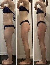 20代　中半身10回|医療提携エステティックサロン　痩身専門Soin