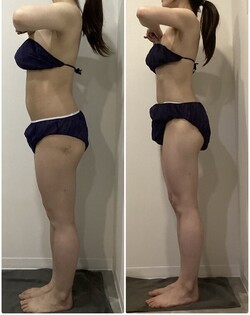 30代　全身5回|医療提携エステティックサロン　痩身専門Soin