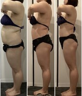 Body　症例|医療提携エステティックサロン　痩身専門Soin