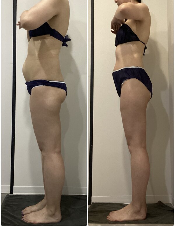 Body　症例|医療提携エステティックサロン　痩身専門Soin