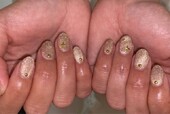 「ハンド フラッシュマグネット＋パーツ」明るくなるキラキラ具合で全面的に光らせています☆|Nail Salon Linda