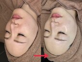 ララピール≪Before⇔After≫①|naturax　恵比寿店