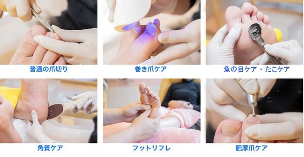 各種フットケア|ドクターネイル爪革命　京都出町店