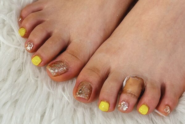 「フット ワンカラー」人気のラメと蛍光カラーの組み合わせです！ 夏本番カラーで可愛いです^_^|Nail Salon Linda