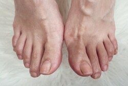 「フットケア」キューティクルケアと角質ケアでナチュラルな美しさです。|Nail Salon Linda