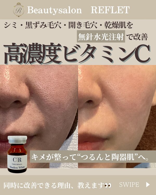 キメの乱れ”“くすみ”“乾燥毛穴” のお悩みに✨|Beautysalon REFLET