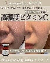 キメの乱れ”“くすみ”“乾燥毛穴” のお悩みに✨|Beautysalon REFLET