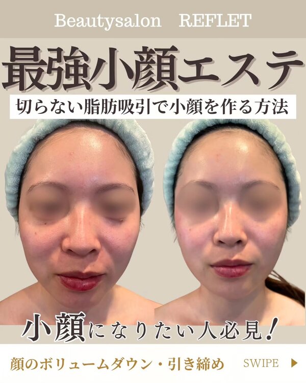 最強小顔エステ|Beautysalon REFLET