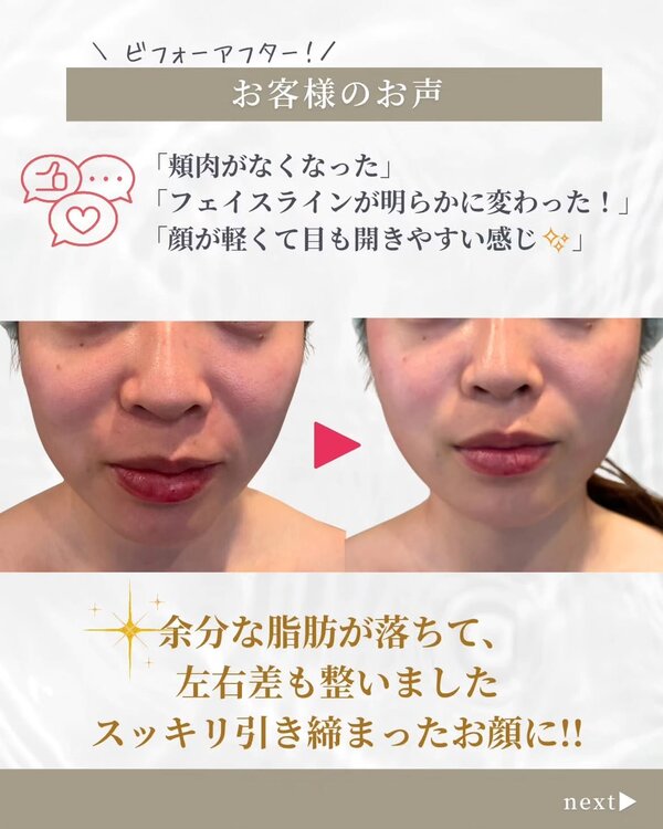 最強小顔エステ|Beautysalon REFLET