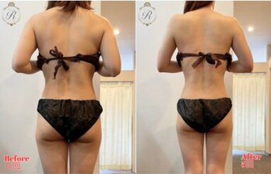 背中美人✨|Beautysalon REFLET