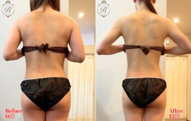 背中美人✨|Beautysalon REFLET