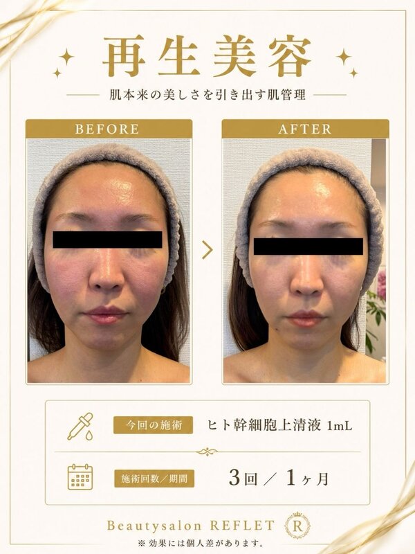 再生美容✨|Beautysalon REFLET
