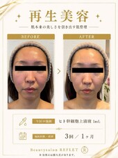 再生美容✨|Beautysalon REFLET