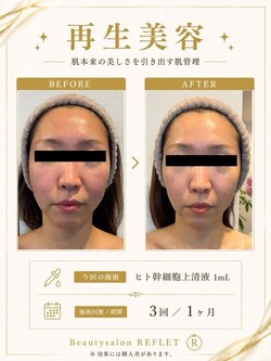 再生美容✨|Beautysalon REFLET