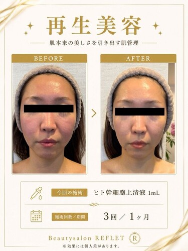 再生美容✨