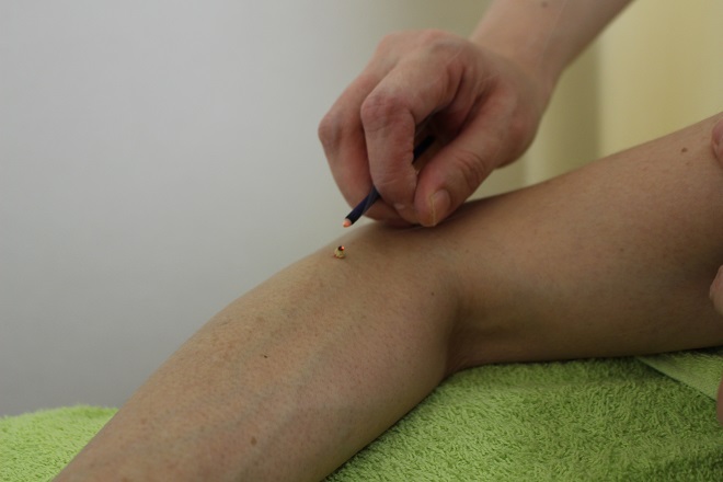 鍼灸治療院 リ・フリー | 北区/東区周辺のエステサロン