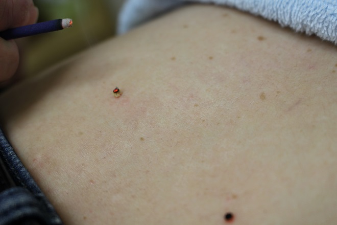 鍼灸治療院 リ・フリー | 北区/東区周辺のエステサロン