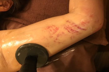 アレビヤン | 日本橋のエステサロン