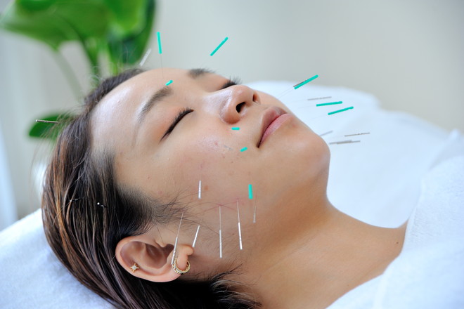 美容鍼灸サロン はりプラス | 港北ニュータウンのリラクゼーション