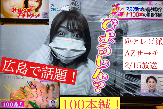 美容鍼×整体×アイラッシュ ～Raywave～ | 袋町/本通/紙屋町/立町のリラクゼーション