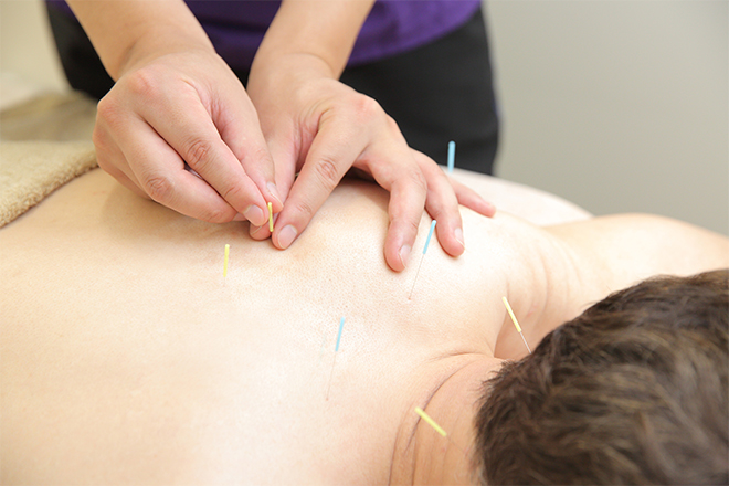 美容鍼×整体×アイラッシュ ～Raywave～ | 袋町/本通/紙屋町/立町のリラクゼーション