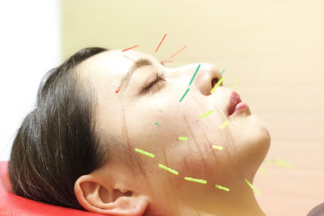 BB整体スタジオ 幡ヶ谷店(Ekichika整骨院・鍼灸院) | 笹塚のエステサロン