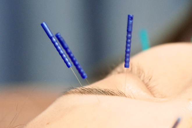 美容鍼灸BIHADA | 町田のエステサロン 美容鍼灸BIHADA | 町田のエステサロン