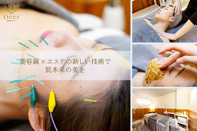 美容鍼灸サロン Deer | 大通のエステサロン