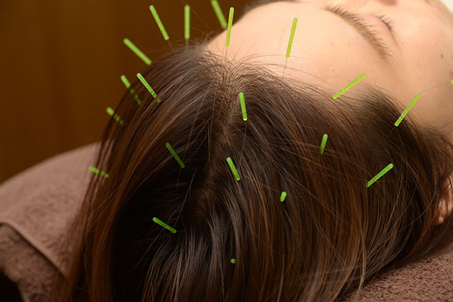 ひかり鍼灸治療院 | 高槻のリラクゼーション ひかり鍼灸治療院 | 高槻のリラクゼーション