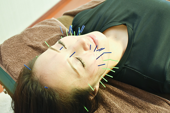 アムラス鍼灸 | 三軒茶屋のリラクゼーション