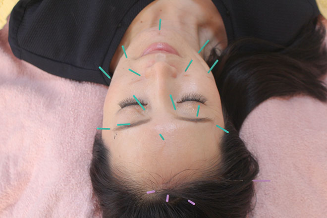 とむはりきゅうあん美容鍼灸治療院 | 茨木のエステサロン とむはりきゅうあん美容鍼灸治療院 | 茨木のエステサロン