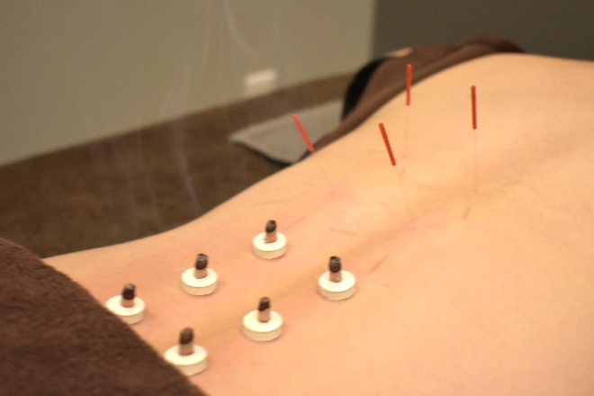 マッサージとはり灸のお店 BISIN | 名駅のリラクゼーション