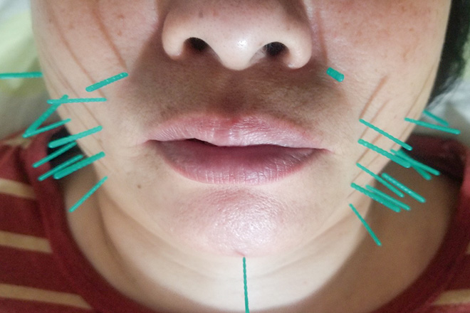 こじま鍼灸院 | 藤井寺のリラクゼーション