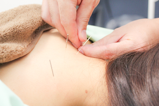 鍼灸整体院 蒼 | 港北ニュータウンのリラクゼーション