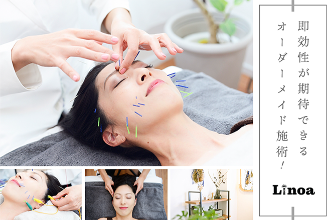 Linoaはり灸院 | 関内のリラクゼーション