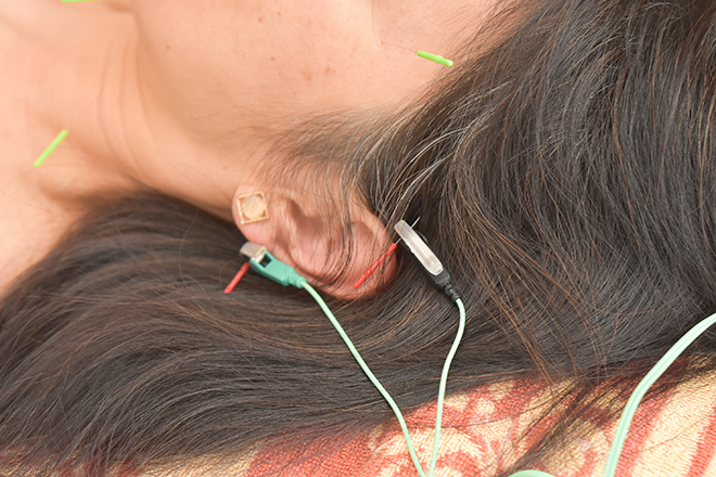 芦屋♡心こ宝鍼灸整体院 | 芦屋のリラクゼーション