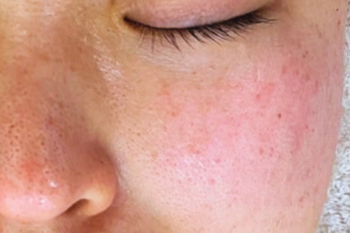 soa+ | 心斎橋のエステサロン