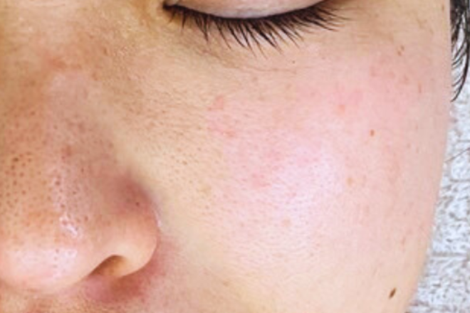 soa+ | 心斎橋のエステサロン