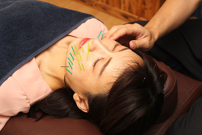 UESUGI美容鍼灸整骨院 | 三島のエステサロン UESUGI美容鍼灸整骨院 | 三島のエステサロン