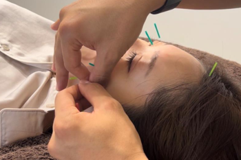 美容鍼灸整体サロン memola | 熊本のエステサロン
