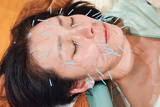 治療の森 鍼灸整骨院 | 静岡のエステサロン