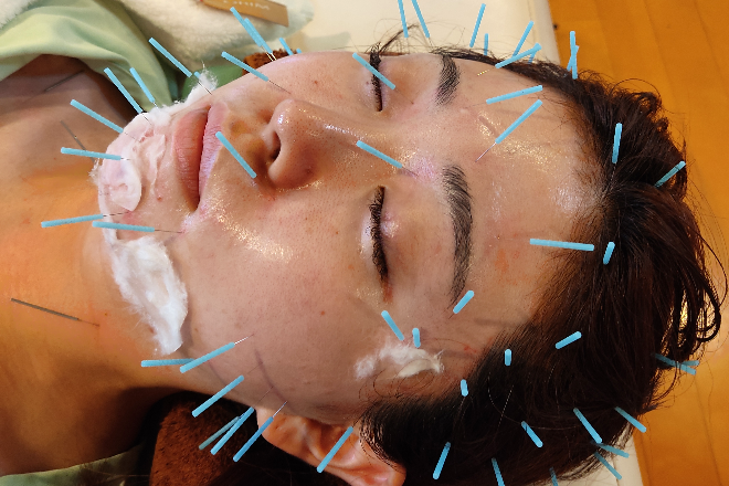 治療の森 鍼灸整骨院 | 静岡のエステサロン