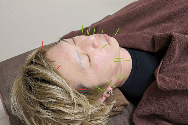 養生庵 希衣鍼灸治療院 | 松山のエステサロン