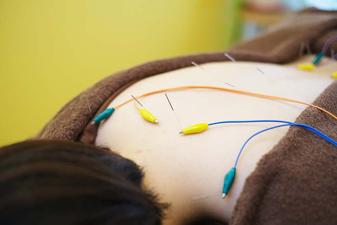 鍼灸治療室さねよし | 自由が丘のリラクゼーション 鍼灸治療室さねよし | 自由が丘のリラクゼーション