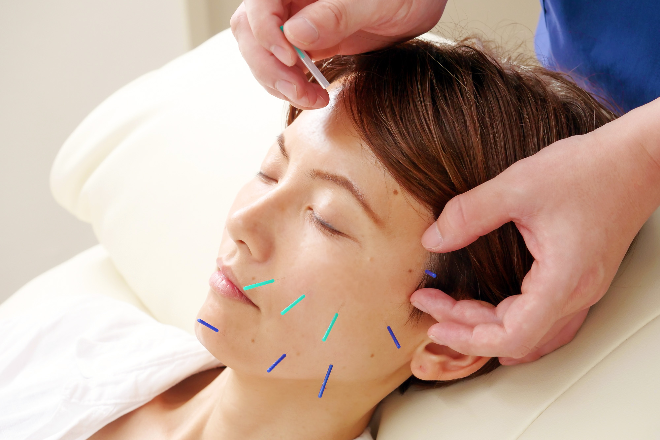 鍼灸×整体salon i | 堺のリラクゼーション