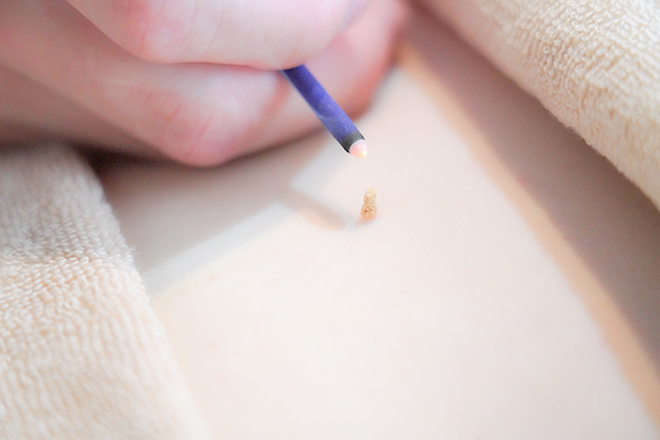 鍼灸院はりえくぼ | 福島のリラクゼーション 鍼灸院はりえくぼ | 福島のリラクゼーション