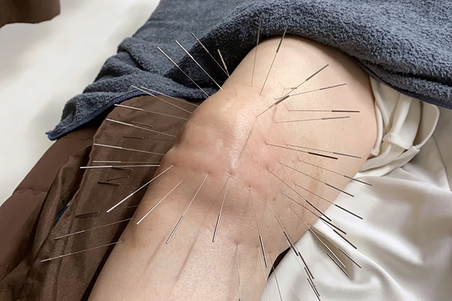 シャンス鍼灸整体院 西原町/骨格矯正/美容鍼灸 | 浦添のリラクゼーション