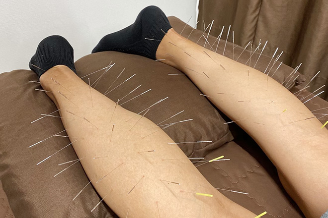 シャンス鍼灸整体院 西原町/骨格矯正/美容鍼灸 | 浦添のリラクゼーション